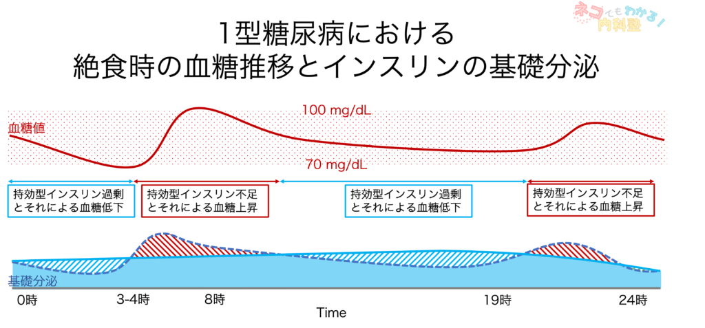 1型糖尿病における絶食時の血糖推移と基礎分泌