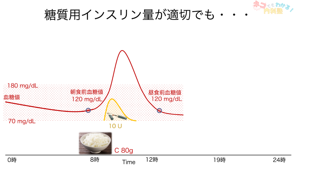 糖質インスリン比が適切でも1