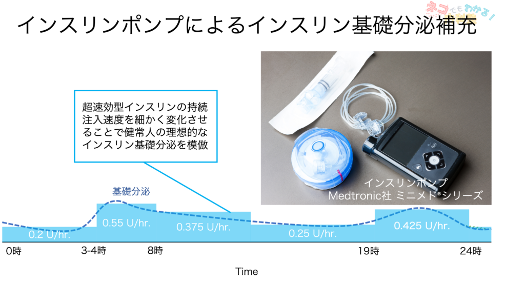 インスリンポンプによる基礎分泌