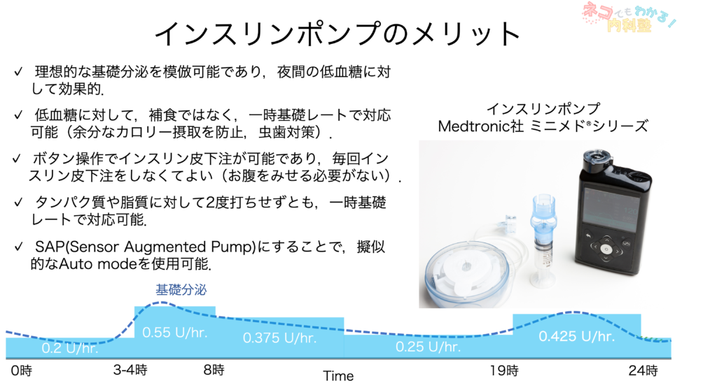 インスリンポンプのメリット
