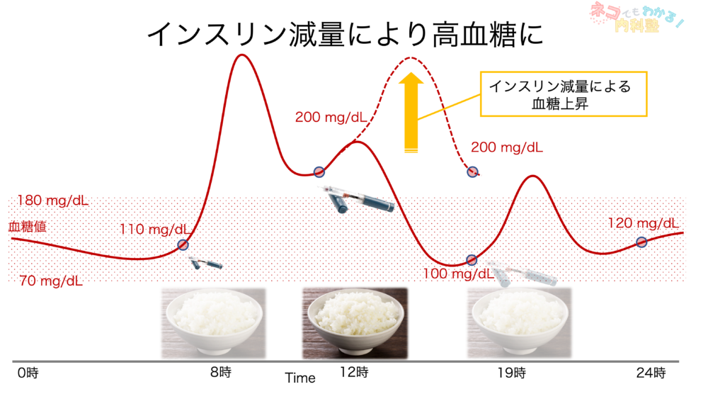 インスリン減量により高血糖に