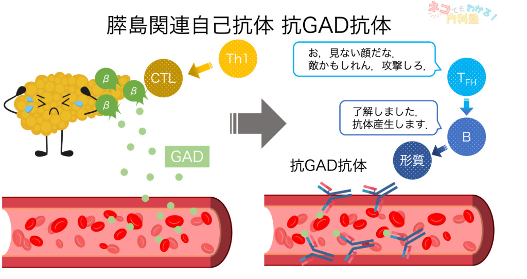 膵島関連自己抗体；抗GAD抗体