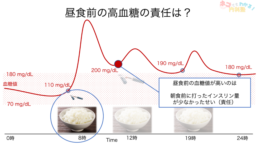 昼食前高血糖の責任インスリンは朝食前の超速効型インスリン