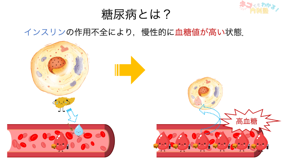 糖尿病とは？