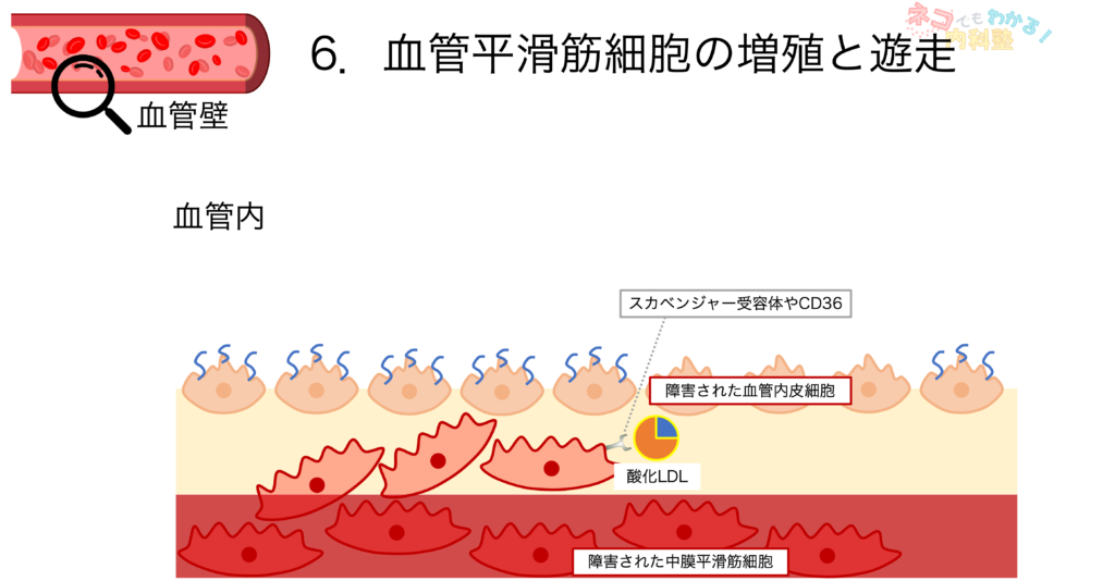 血管平滑筋細胞の増殖と遊走