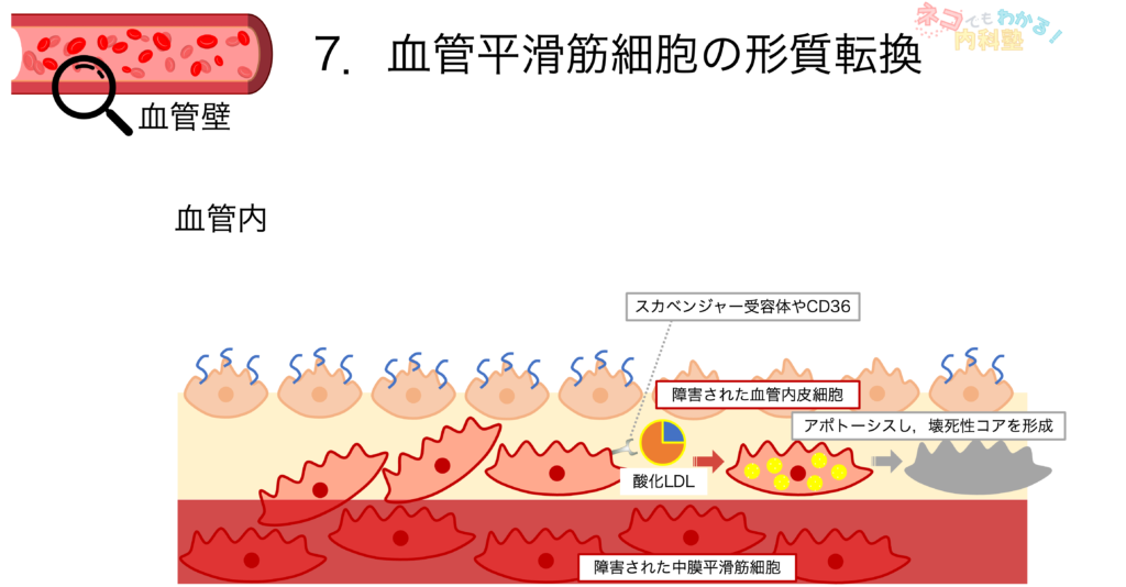 血管平滑筋細胞の形質転換